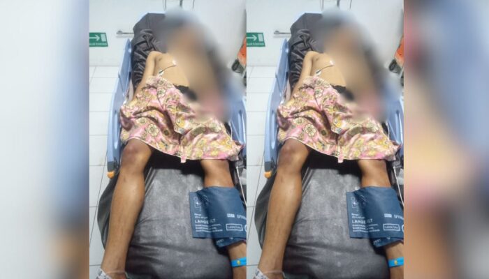 Tawuran di Padang, Tangan Kiri Korban Putus Ditebas Celurit
