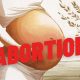Ilustrasi aborsi. (Foto: Ideogram/Ingatlah.com)