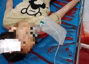 Pelajar 12 Tahun di Kampar Tewas Tertembak Senapan Angin di Kepala