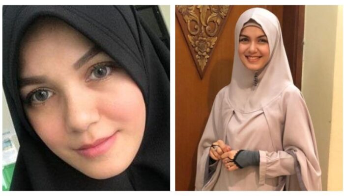 Dituduh Tabrak Lari, Ini Jawab Nadya Almira di Media Sosial