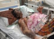 Diduga Terbakar Api Cemburu, Suami di Inhu Nekat Siram Pertalite ke Istri dan Dibakar