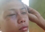 Bocah Bermata Lebam Diduga Dipukul Oknum Aparat, Propam Polda Riau Turun Tangan