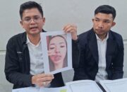 Niat Ingin Cantik Berujung Petaka, 15 Wanita Pekanbaru Jadi Korban Dokter Abal-Abal